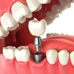 32ac8d_fbc810b45a7a47ac97655ab7833ff8af~mv2